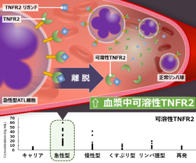 成人T細胞白血病診断の新規バイオマーカーの発見　～可溶性tumor necrosis factor receptor 2の上昇を発見～