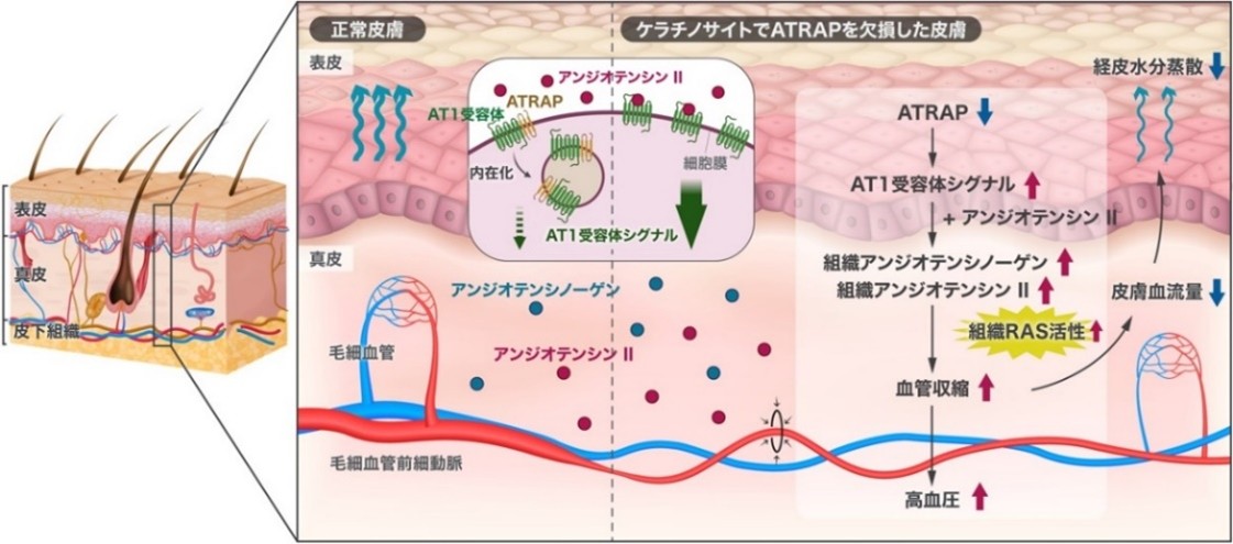 神経脈管学 高血圧の新たな発症メカニズムを解明 －皮膚の微小血管収縮と